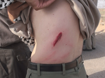 عکسهایی از حمله نیروهای عراقی به اشرف