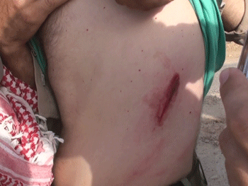 عکسهایی از حمله نیروهای عراقی به اشرف