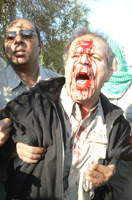 حمله به ساکنان اشرف در بیمارستان و مجروح و مضروب شدن دهها تن از مجاهدان